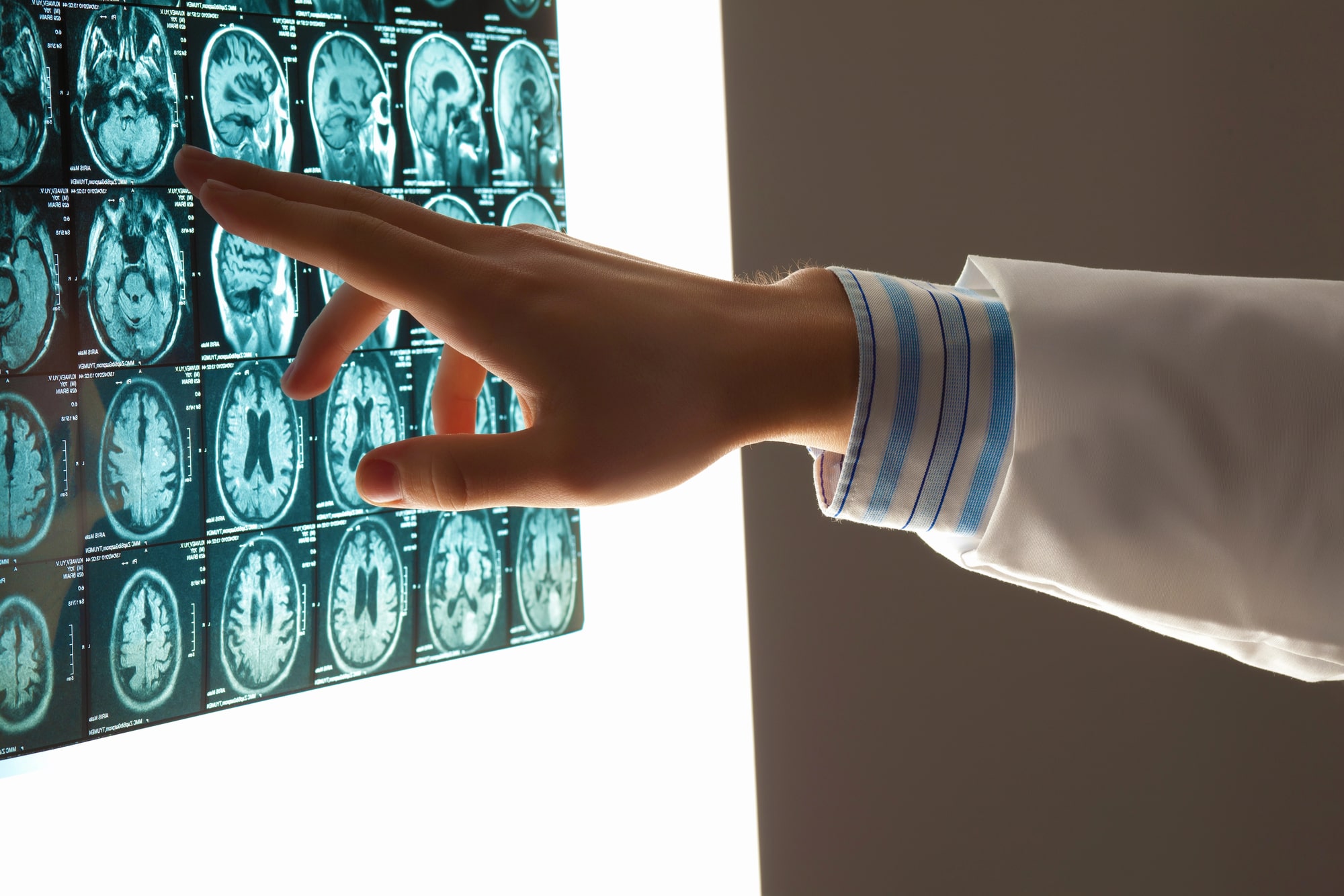 brain injury lawyer Omaha, NE