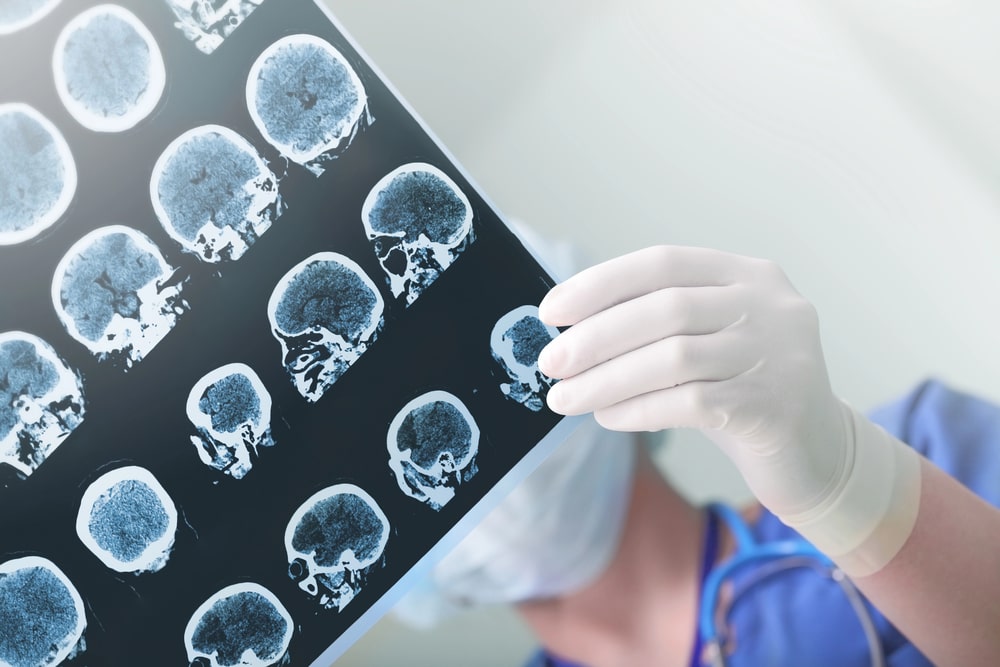 Omaha, NE brain injury lawyer consultation