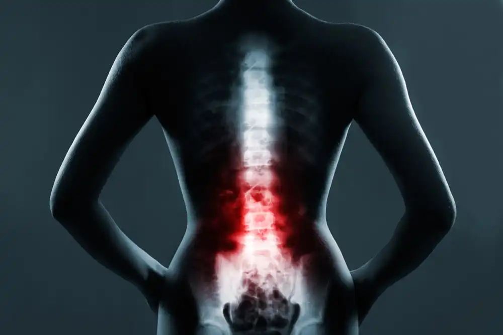 spinal cord injury lawyer