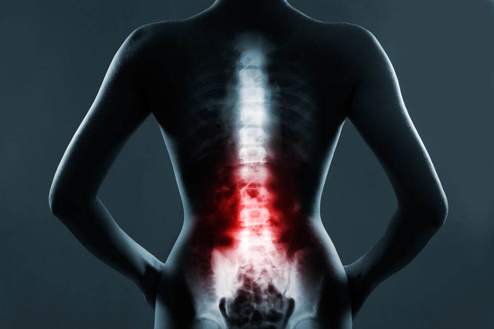 Spinal Cord Injury Lawyer La Vista, NE